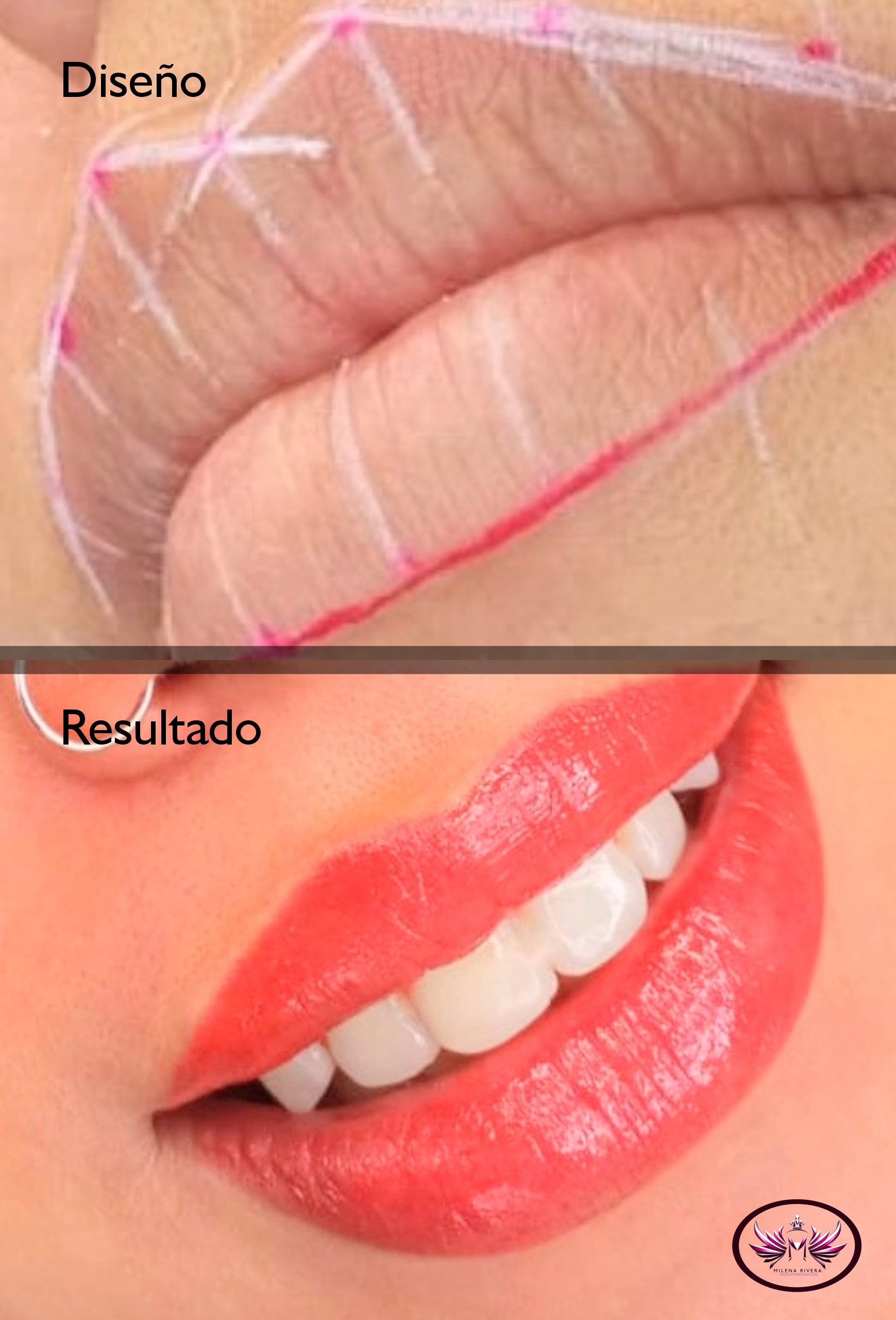 labios-pigmentados-antes-y-despues